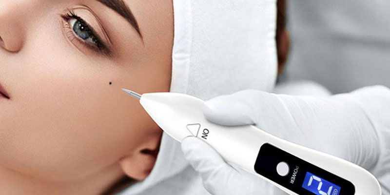 Mole removal with plasma