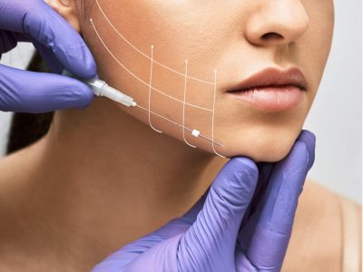 facial lifting thread thread facelift with arrows on face for womans skin procedure facial s1024x1024wisk20cMCMRWWZ0ghADNXX9HHsCbxawMV83qLj9kJn0gpQVZZc 1