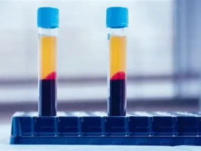 prp